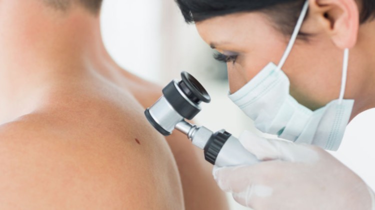 Thomy® Folia, melanoma, UV védelem, bababarát fólia, kisállatbarát fólia, szolárium